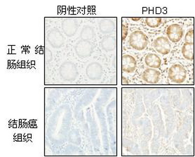 营养所在结直肠癌研究领域取得新进展