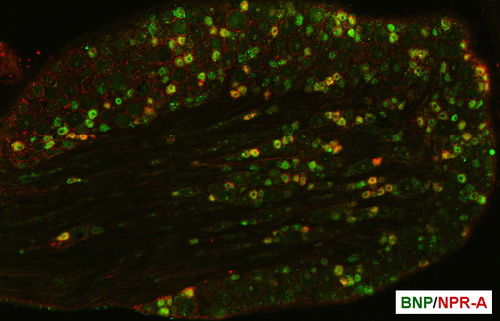 激活伤害性感觉神经元中b型钠尿肽信号通路可