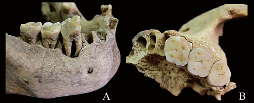 古脊椎所等对青龙泉新石器时代居民牙齿磨耗及