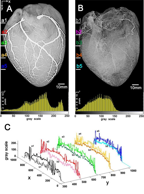 科学家提出液态金属血管造影术可实现高清晰血