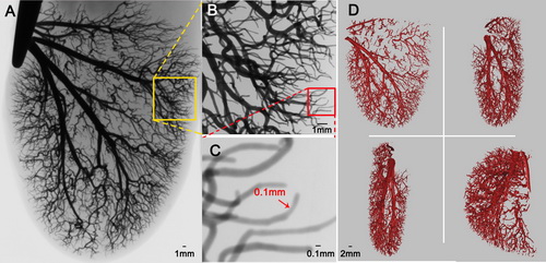 科学家提出液态金属血管造影术可实现高清晰血