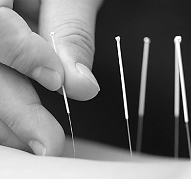 韩济生:传统针刺疗法成治病新方