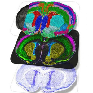 跨物种哺乳动物脑细胞发育图绘成