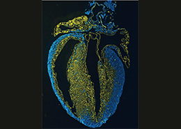 发现新生期心脏具有重新生成冠状动脉的能力