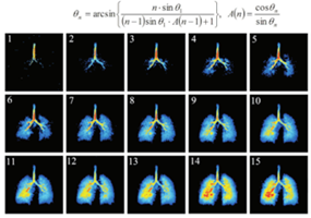 能为肺部做磁共振的临床检测中心落户武汉