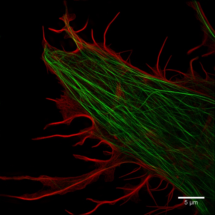 说明:由结构照明超分辨荧光显微镜omx拍摄到的活细胞内的微管与微丝